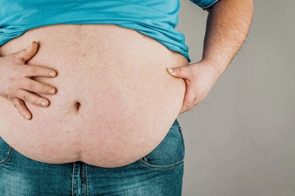 Sovrappeso Del Corpo Una Persona Con Mani Che Toccano Addome — Foto Stock