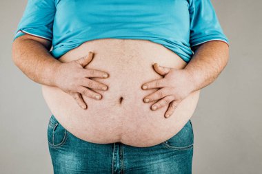 Elleri karnına dokunan bir kişinin aşırı kilolu vücudu. Obezite kavramı.