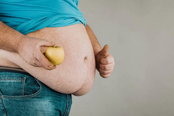 Gordo Tem Uma Maçã Frente Estômago Conceito Dieta Alimentação Saudável — Fotografia de Stock