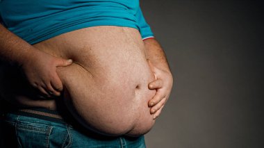 Elleri karnına dokunan bir kişinin aşırı kilolu vücudu. Obezite kavramı.