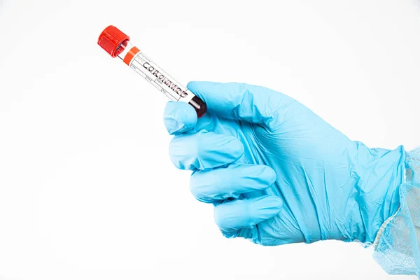 Arzt Hält Eine Ampulle Mit Blut Der Probe Für Coronavirus — Stockfoto
