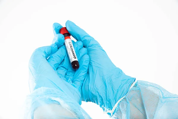 Arzt Hält Eine Ampulle Mit Blut Der Probe Für Coronavirus — Stockfoto