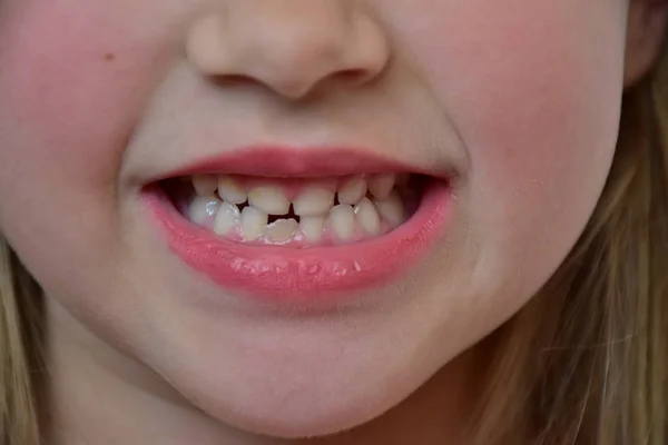 Dents Bébé Bouche Ouverte — Photo