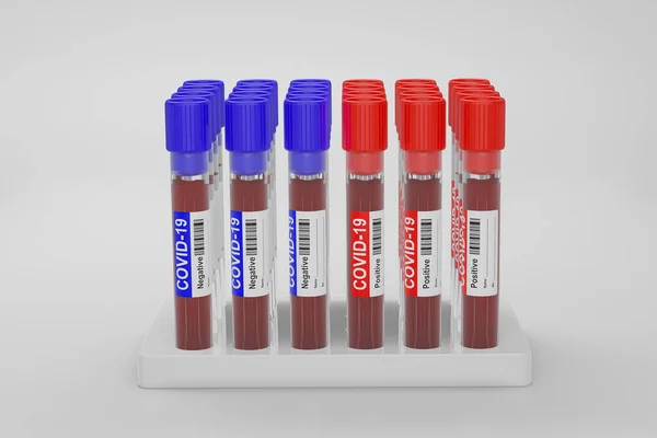 Bloed Plasma Reageerbuisjes Die Zijn Geanalyseerd Covid 2019 Ncov Coronavirus — Stockfoto
