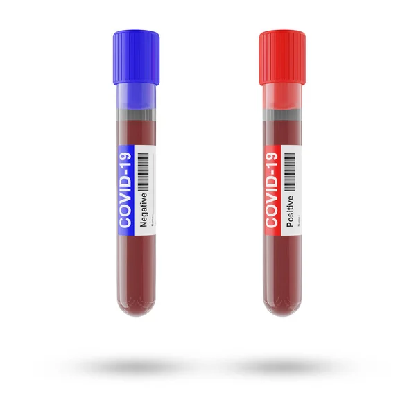 检测试管中的血液和血浆被分析为Covid 2019 Ncov或Coronavirus 以找到阻止大流行病的方法 结果是阴性和红色管 结果在实验室呈阳性 — 图库照片#