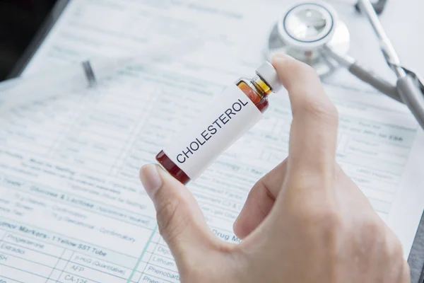 Il medico maschio tiene in mano il farmaco per il colesterolo — Foto Stock