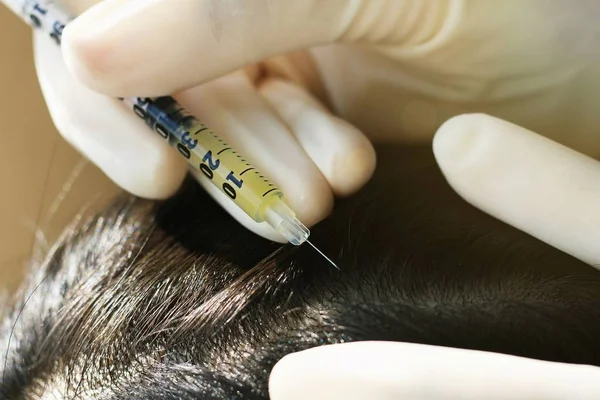 Doktor hastanın saç ve saç derisi, dermatolog sınavına derisi bozukluğu enjekte. (Seçici odak)