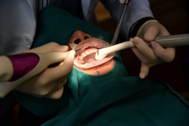 Diş bakımı kontrolü, Diş Hekimi muayene ve diş kliniğinde diş tedavisi yapıyor, diş eti hastalığı sorunları önlemek için diş temizliği ve ölçekleme için yıllık ziyaret, Sağlıklı ağız hijyenik.