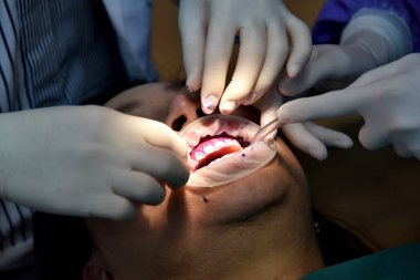 Diş bakımı kontrolü, Diş Hekimi muayene ve diş kliniğinde diş tedavisi yapıyor, diş eti hastalığı sorunları önlemek için diş temizliği ve ölçekleme için yıllık ziyaret, Sağlıklı ağız hijyenik.