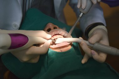 Diş bakımı kontrolü, Diş Hekimi muayene ve diş kliniğinde diş tedavisi yapıyor, diş eti hastalığı sorunları önlemek için diş temizliği ve ölçekleme için yıllık ziyaret, Sağlıklı ağız hijyenik.