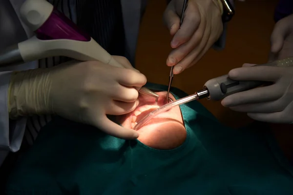 Οδοντιατρική Φροντίδα Επάνω Οδοντίατρος Εξέταση Και Κάνει Θεραπεία Δοντιών Στην — Φωτογραφία Αρχείου