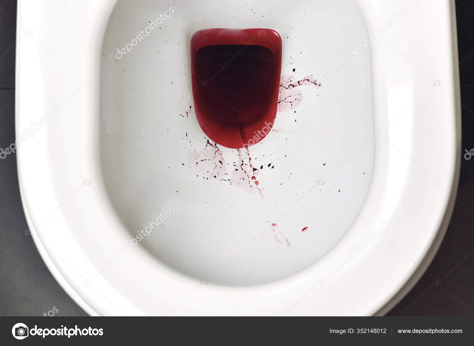 Blood Toilet Bowl Rectal Bleeding Hemorrhage Blood Urine Health Warning