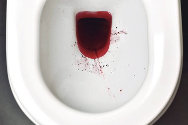 Klozette kan, rektal kanama, idrarda kan ciddi hastalık belirtileri için sağlık uyarısı..