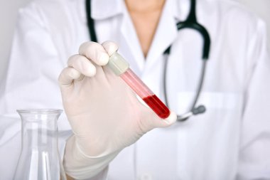 Coronavirus pozitif kan testi, virüs salgını, aşı ve Covid-19 salgını için yeni ilaç araştırmaları, sağlık kontrolü ekipmanları.