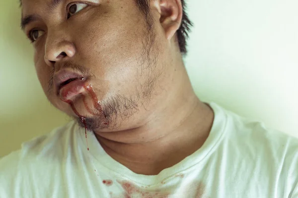 Portret van Aziatische jonge man voelen pijn — Stockfoto
