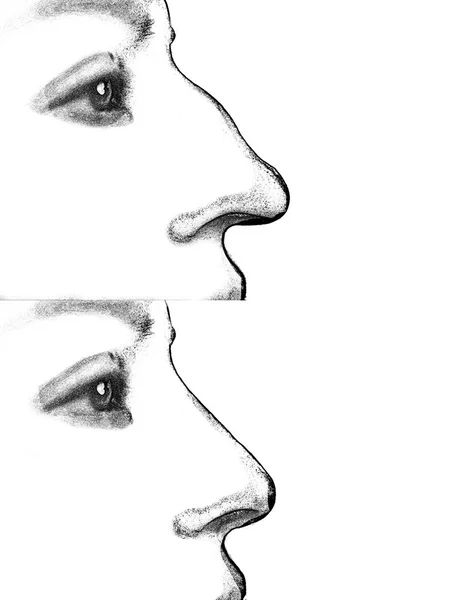 Korekcja nosa z tworzywa sztucznego — Zdjęcie stockowe