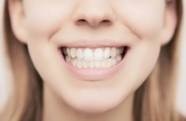 Sonrisa Con Diente Blanco Cuidado Dental —  Fotos de Stock