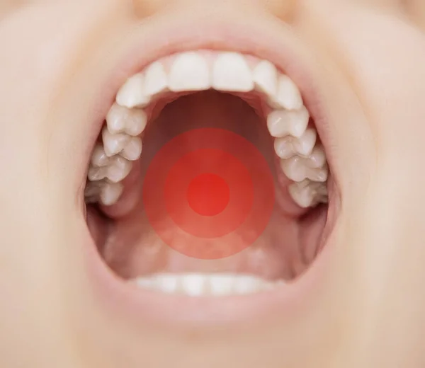 Dolore Denti Bocca Aperta Con Dolore Cura Dei Denti — Foto Stock
