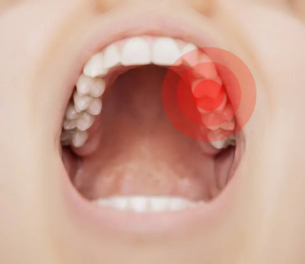 Tootache Ağrı Toothcare Ile Açık Ağız — Stok fotoğraf