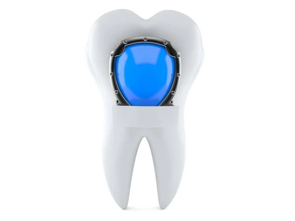 Dente com protetor de proteção — Fotografia de Stock