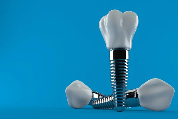 Implante dental — Foto de Stock