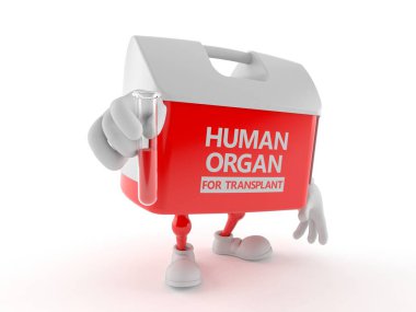 Cam örneği taşıyan nakil kutusu karakteri