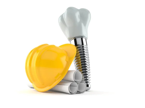 Implant stomatologiczny z planami — Zdjęcie stockowe