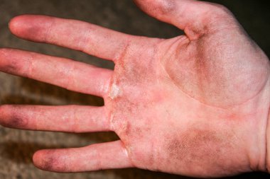 Erkeklerin kirli elleri. Ellerinde nasır var. Kirli eller