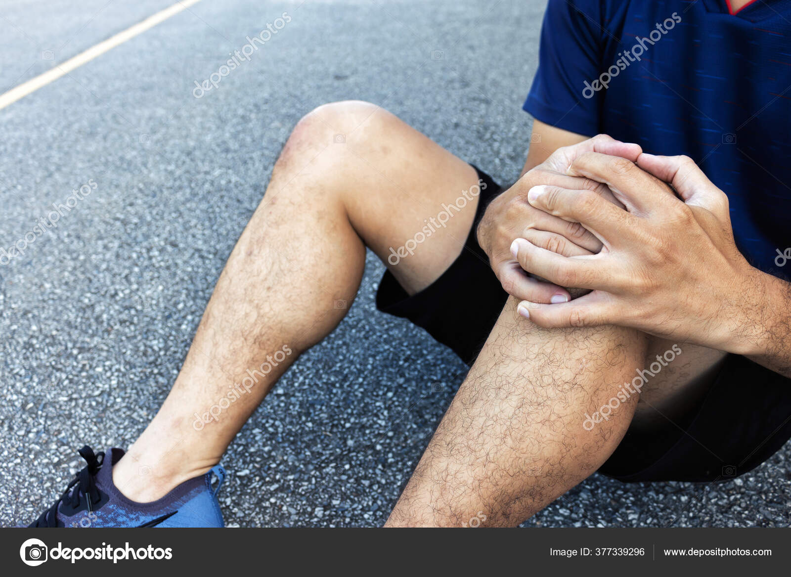 Повреждение коленного сустава 3 степени