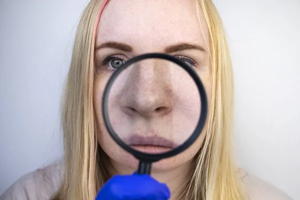 Expanded Pores Black Spots Acne Rosacea Close Nose Woman Being — Stock Photo, Image