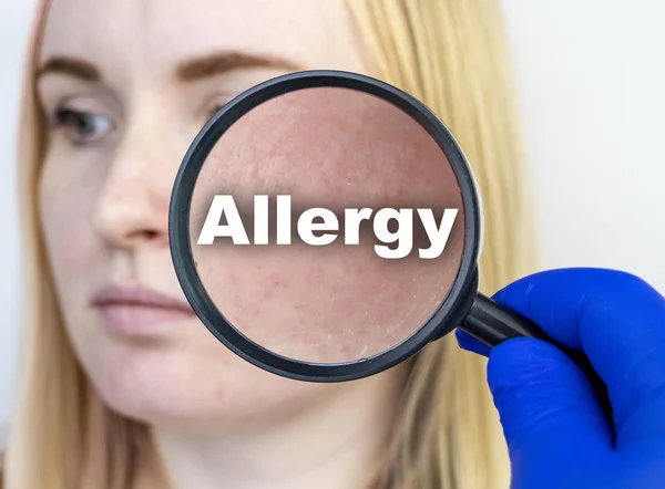 Allergie Éruption Cutanée Gros Plan Une Femme Est Examinée Par — Photo