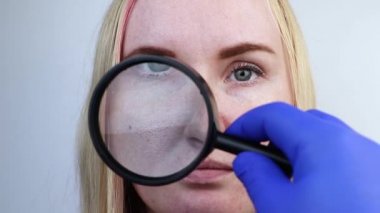 Genişlemiş gözenekler, siyah noktalar, sivilceler, yanakta yakın plan rosacea. Bir kadın bir doktor tarafından muayene ediliyor. Dermatolog deriyi büyüteçle inceliyor, büyüteçle.