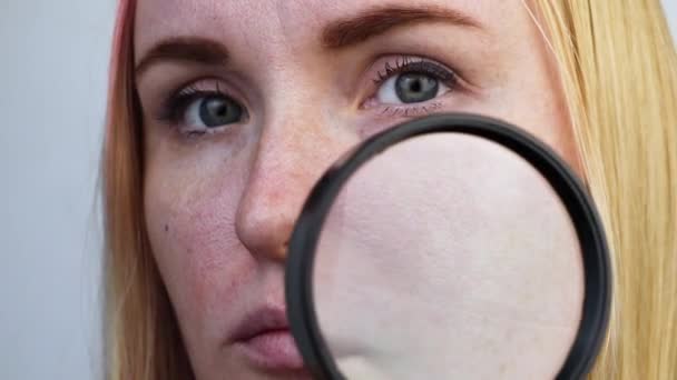 扩张的迷迭香 鼻子上的特写 一位妇女正在接受医生的检查 皮肤科医生用放大镜 放大镜检查皮肤 — 图库视频影像