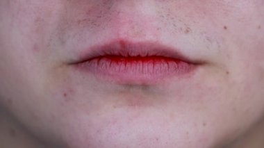Gum bleeding and inflammation close up. A man examined by a dentist. The diagnosis of gingivitis