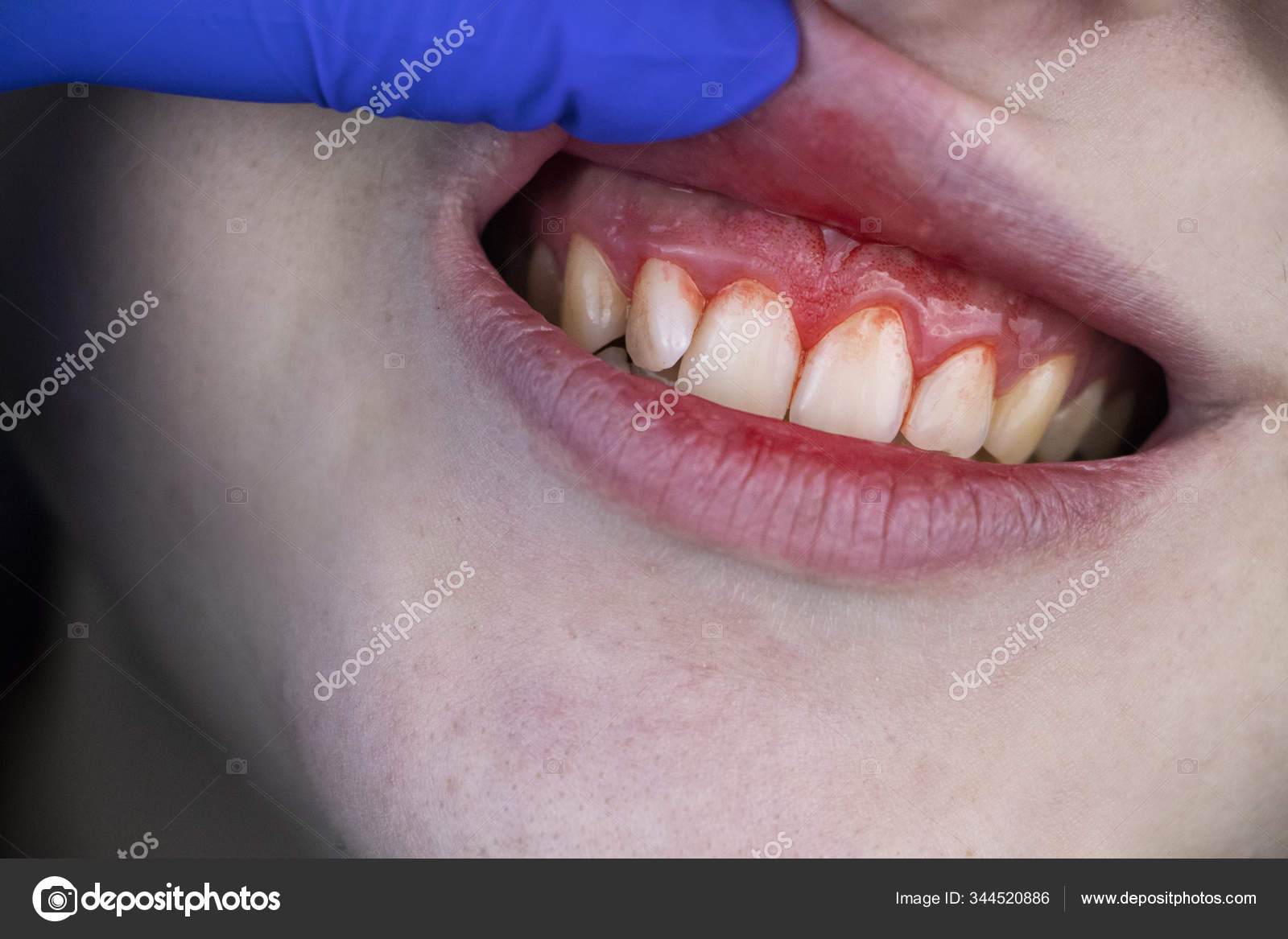 Barn med påførte hodeskader (abusive head trauma) – medisinske og juridiske  aspekter — NRF, image size:1600x1167