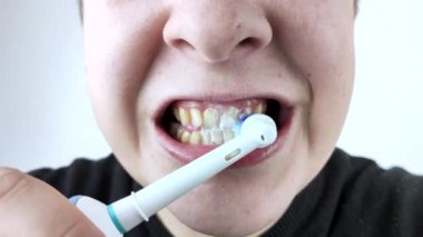 Bir adam sanki aynaya bakıyormuş gibi dişlerini elektrikli fırçayla fırçalar. Ağız boşluğunda hijyen. Çalışan bir elektrikli fırçanın makro videosu