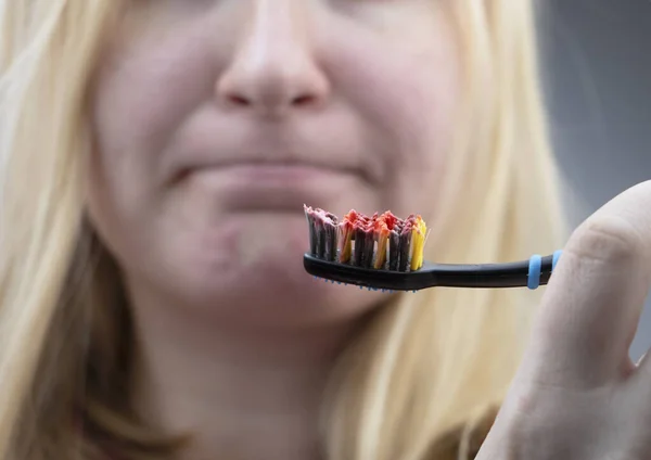 Zahnbürste Mit Blutnahaufnahme Eine Frau Entdeckte Beim Zähneputzen Blutendes Zahnfleisch — Stockfoto