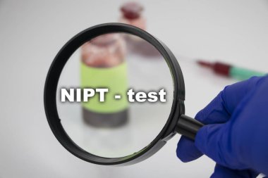Diyabetik ketoasidoz (eton testi) için bir kan örneği. Doktorun elinde laboratuvar araştırmaları için üzerinde kan örneği olan bir test tüpünün bulunduğu bir büyüteç var..