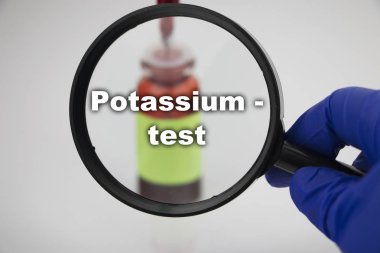 Diyabetik ketoasidoz (eton testi) için bir kan örneği. Doktorun elinde laboratuvar araştırmaları için üzerinde kan örneği olan bir test tüpünün bulunduğu bir büyüteç var..