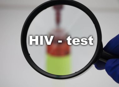 Diyabetik ketoasidoz (eton testi) için bir kan örneği. Doktorun elinde laboratuvar araştırmaları için üzerinde kan örneği olan bir test tüpünün bulunduğu bir büyüteç var..