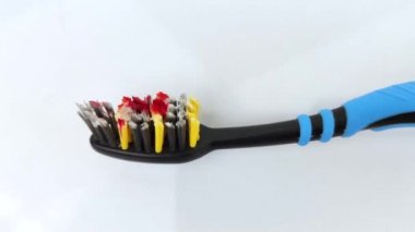 Diş fırçasında kan var. Bir adam dişlerini fırçalarken ve diş etlerini fırçalarken kanayan diş etlerini keşfetti. Dişeti iltihabı veya periodontal hastalık