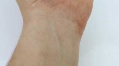 Hasta, bilekteki damarlara kan akışını uyaran yumruğu sıkıştırır ve açar. Analiz için kan örneklerine el hazırlıyorum. Tendonun hareketinin ve damarların şişmesinin makro videosu..