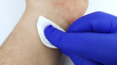 Mavi eldivenli bir doktor tıbbi alkollü pamuk tutuyor ve analiz için kan alacağı yeri siliyor. Kan örnekleri için deri dezenfeksiyonu.