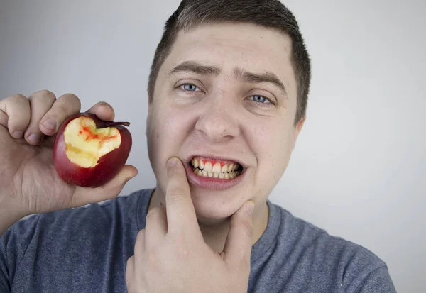 Ein Mann Biss Einen Apfel Und Blut Floss Aus Seinem — Stockfoto