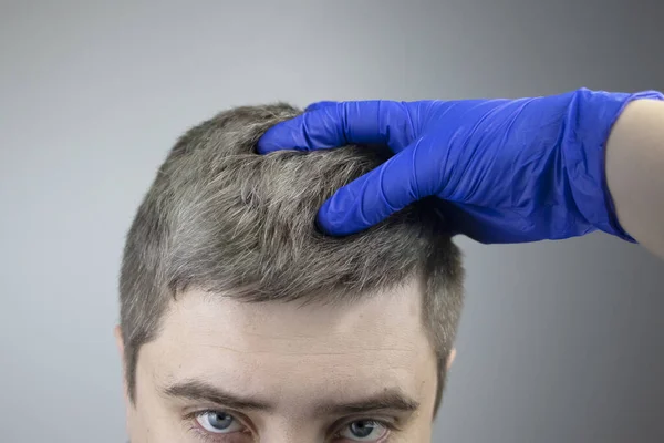 Tricholog Zkoumá Mladé Muže Šedé Vlasy Pod Lupou Dřívější Bělení — Stock fotografie