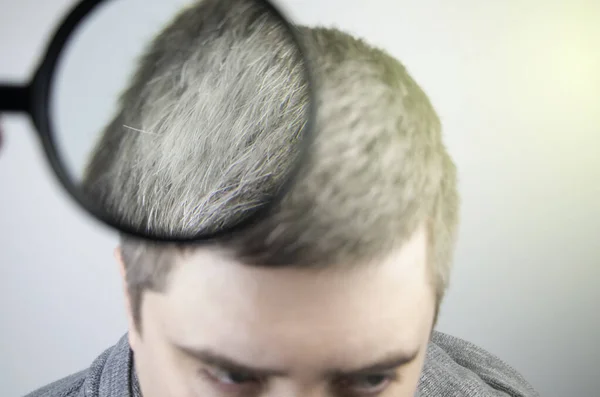 Trichologist Examines Young Mans Gray Hair Magnifying Glass Earlier Bleaching — Stock Photo, Image