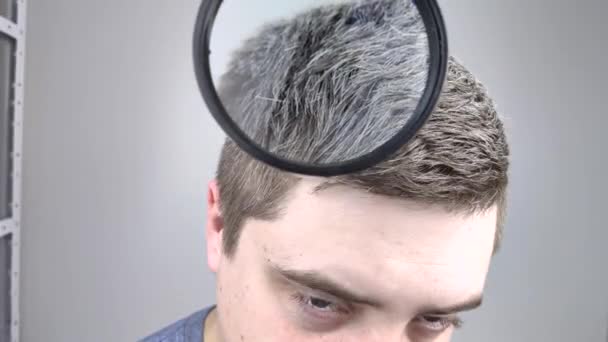 Trichologue Examine Jeune Homme Cheveux Gris Sous Une Loupe Blanchiment — Video