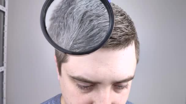 Трихолог Исследует Молодого Человека Седыми Волосами Увеличительным Стеклом Ранее Обесцвечивание — стоковое видео