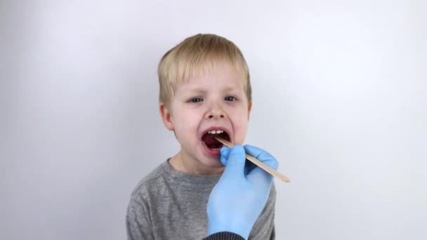 Een Otolaryngoloog Onderzoekt Een Man Keel Met Een Houten Spatel — Stockvideo