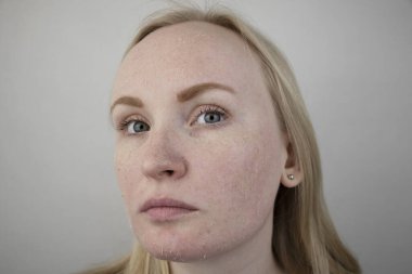 Bir kadın yüzündeki kuru deriyi muayene eder. Soyulma, kabalaşma, rahatsızlık, cilt hassasiyeti. Dermatolog ya da kozmetikçinin randevusundaki hasta, kuruluk için krem seçimi.